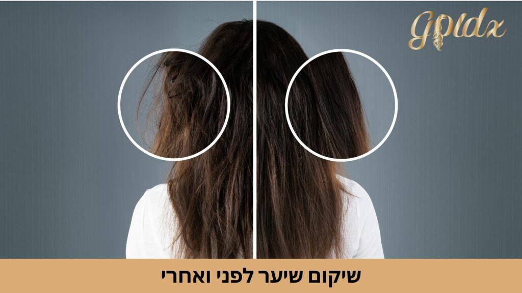 שיקום שיער לפני ואחרי